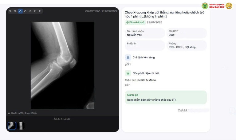 Đây là chức năng chính của cách tra cứu kết quả X-quang, CT scan, MRI online, giúp khách hàng xem lại kết quả và hình ảnh đã chụp ngay trên thiết bị có kết nối Internet.