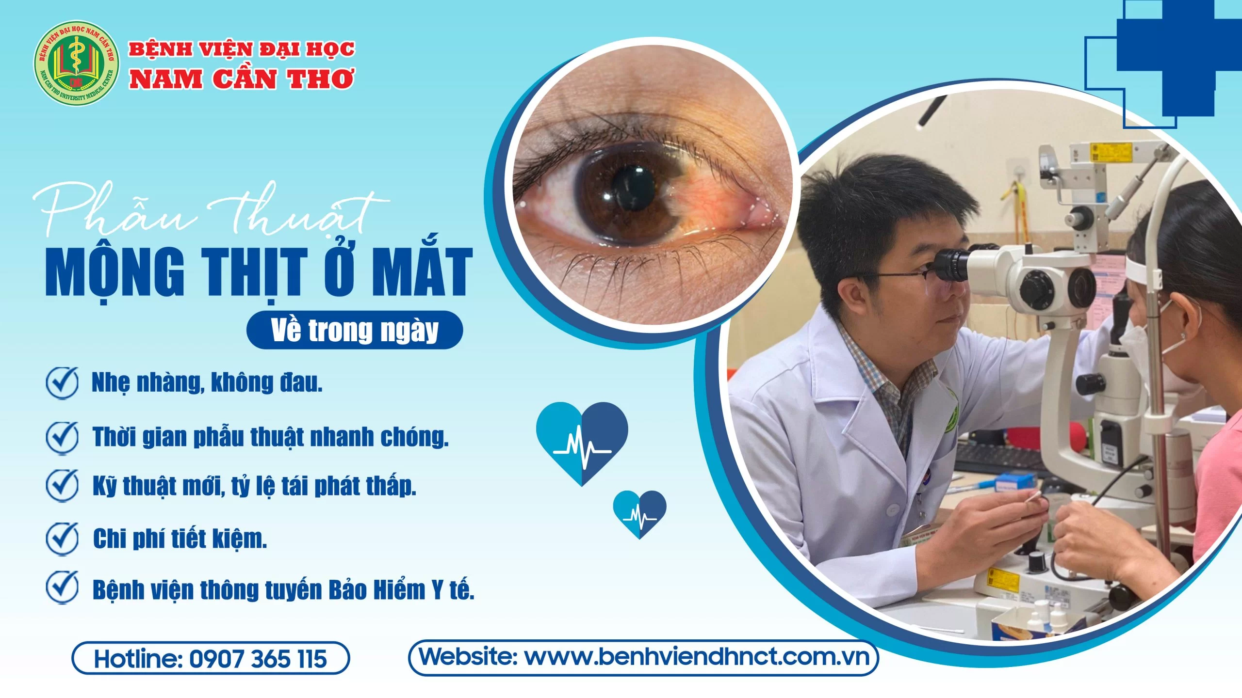 mong thit o mat3x 1 scaled