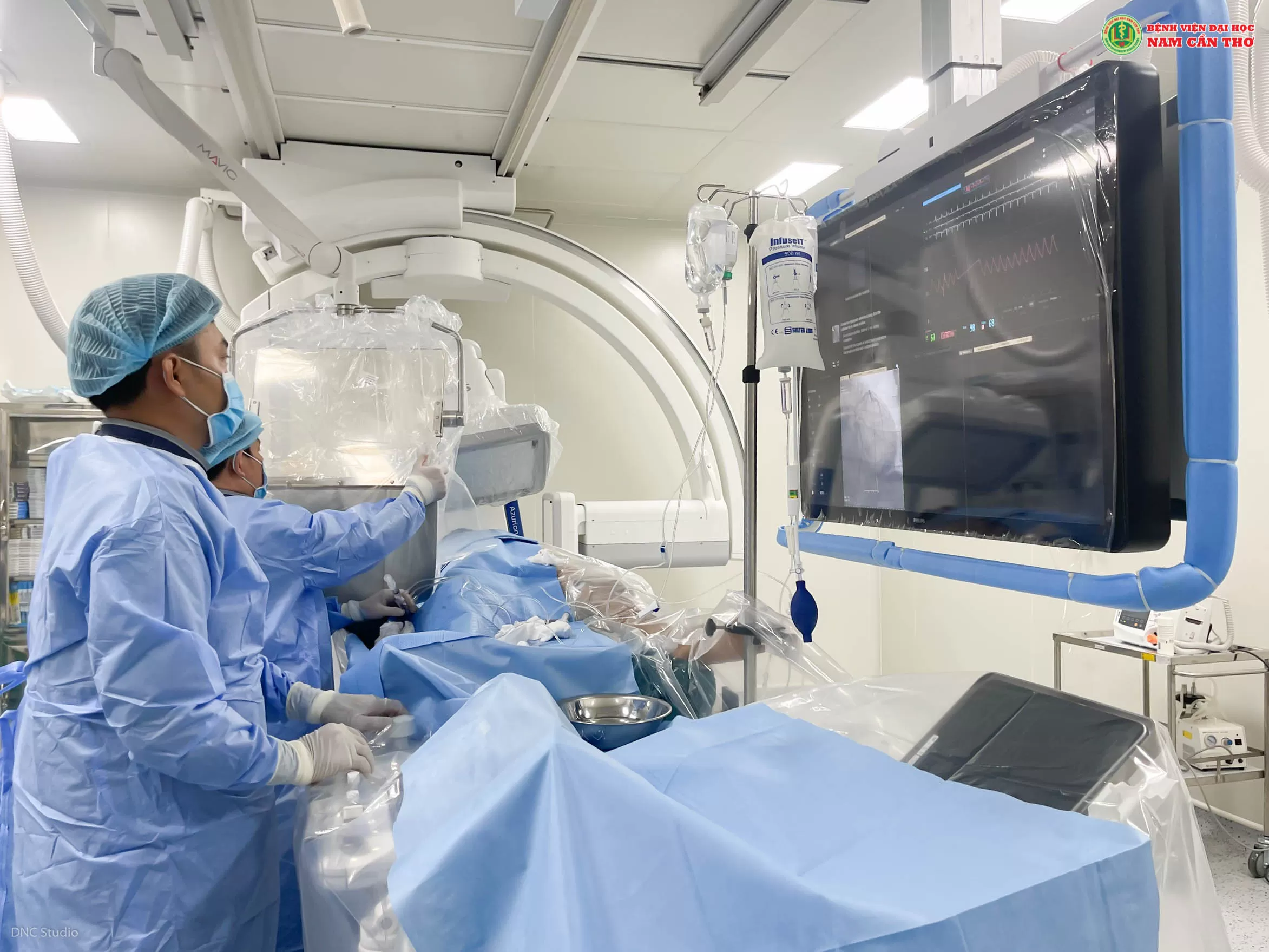 Hệ thống DSA 2 bình diện Philips