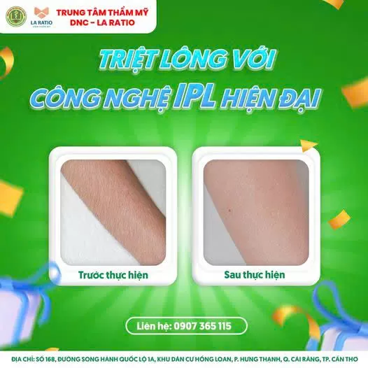 TRIỆT LÔNG VĨNH VIỄN – AN TOÀN – KHÔNG XÂM LẤN TẠI DNC – LARATIO