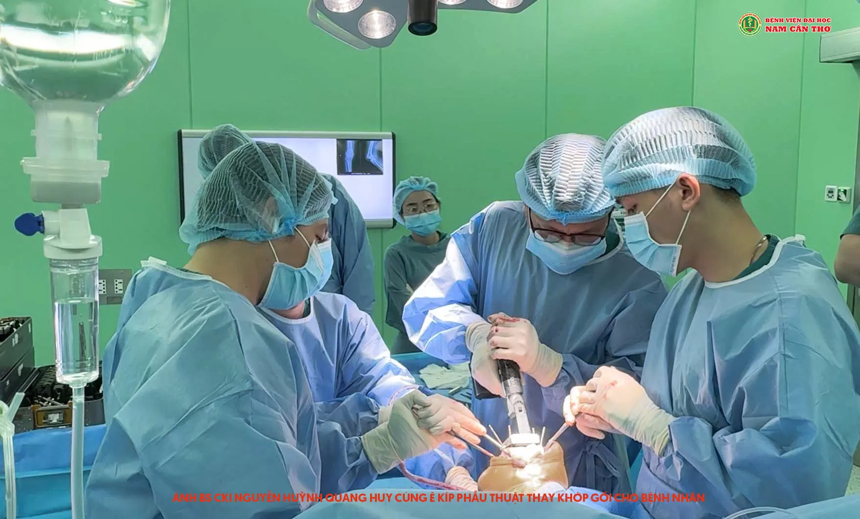 PHẪU THUẬT THAY KHỚP GỐI BÁN PHẦN – BƯỚC TIỀN VƯỢT BẬT CHO CUỘC SỐNG KHÔNG ĐAU 2 PHẪU THUẬT THAY KHỚP GỐI THÀNH CÔNG TẠI BỆNH VIỆN ĐẠI HỌC NAM CẦN THƠ – BƯỚC TIỀN VƯỢT BẬC CHO CUỘC SỐNG KHÔNG ĐAU