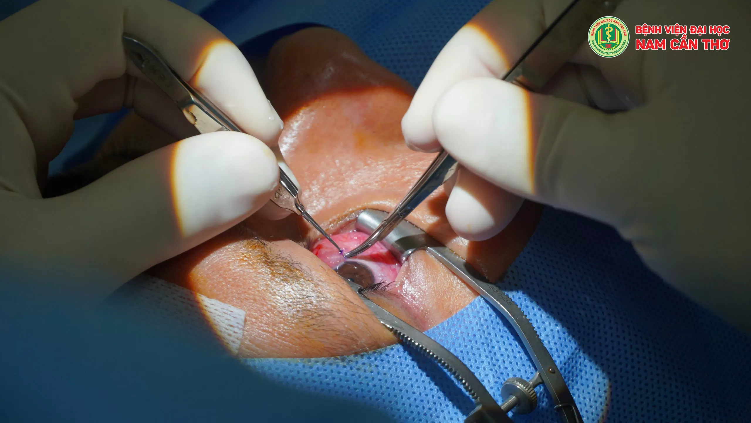 BỆNH VIỆN ĐẠI HỌC NAM CẦN THƠ – KÝ KẾT HỢP TÁC TRAO ĐỔI CÔNG NGHỆ Y KHOA, PHÁT TRIỂN VƯƠN TẦM QUỐC TẾ