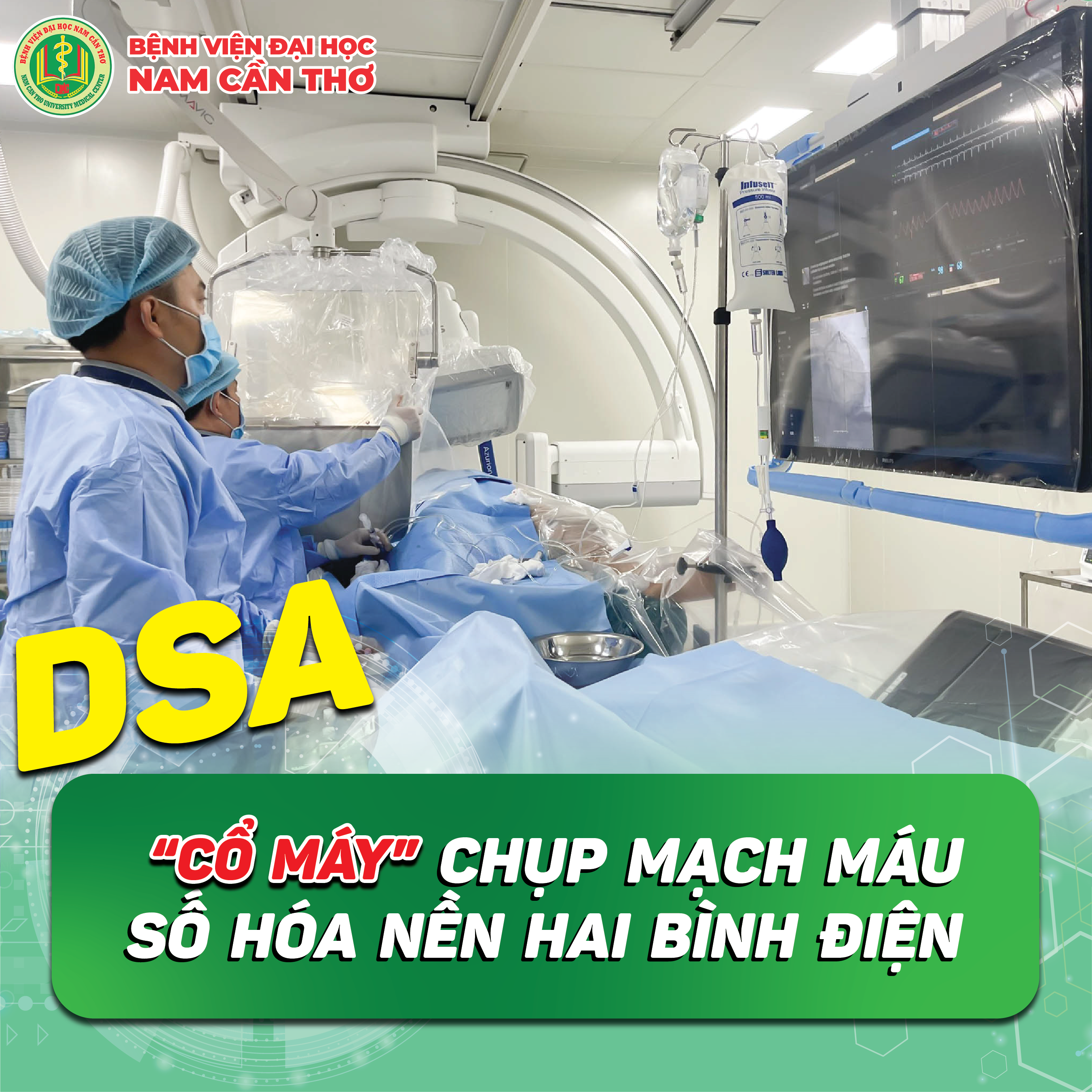 🟢HỆ THỐNG CHỤP MẠCH MÁU SỐ HÓA XÓA NỀN HAI BÌNH ĐIỆN - DSA