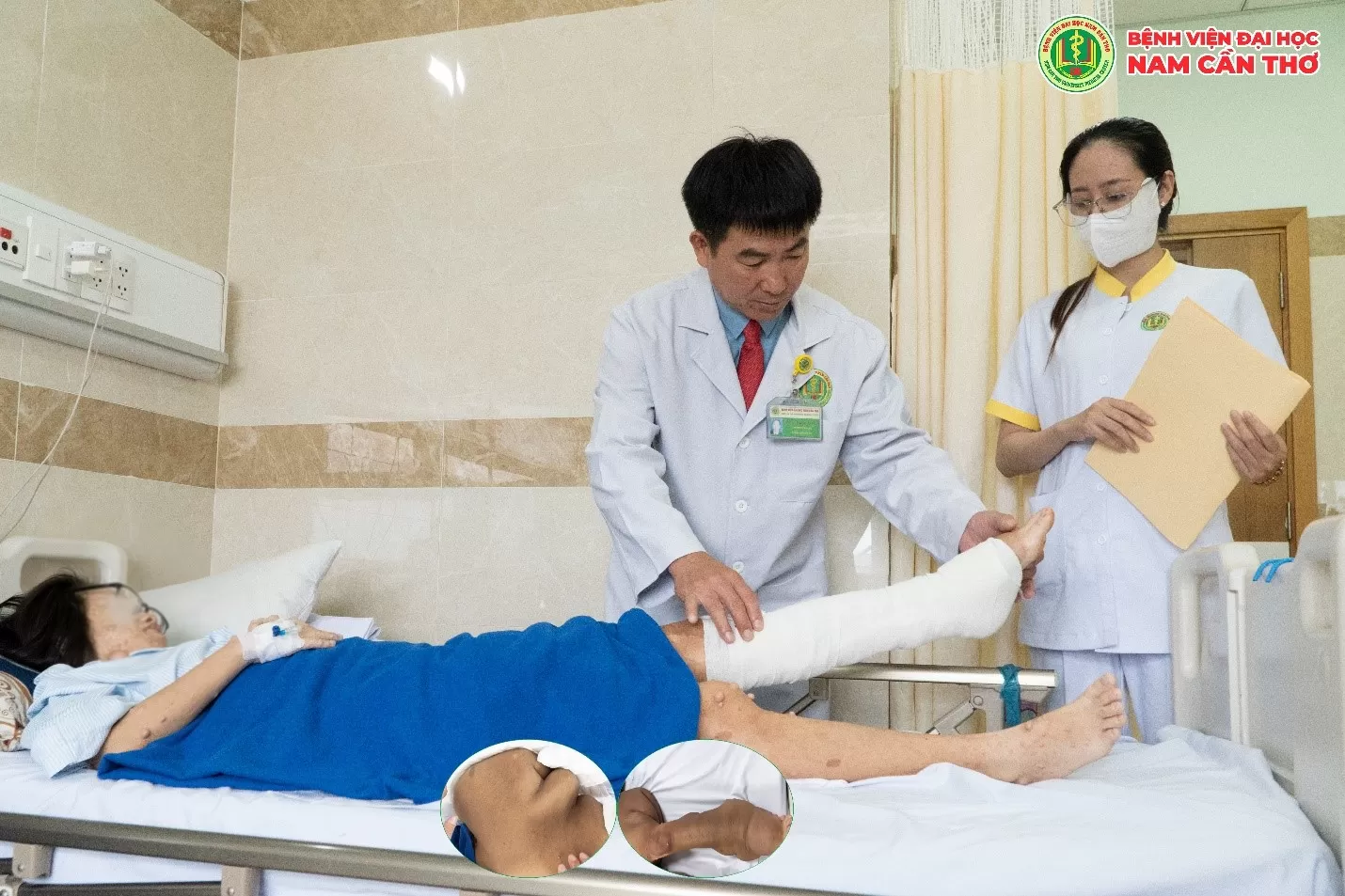 PHẪU THUẬT ĐIỀU TRỊ ĐA KHỐI U SỢI THẦN KINH DƯỚI DA PHỨC TẠP