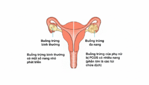 Bia bai 16 Hoi chung buong trung da nang 1