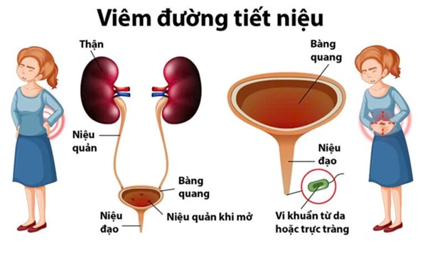 Hinh bai 26