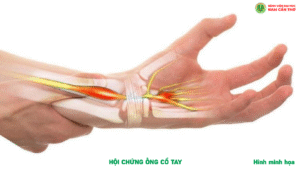 Bia Hoi chung Ong co tay